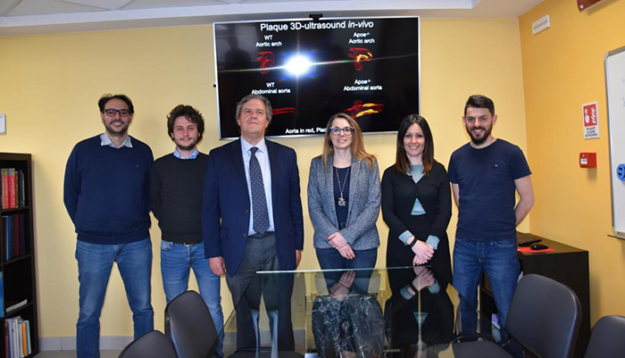 il_gruppo_del_Dipartimento_di_AngioCardioNeurologica_e_Medicita_traslazionale_che_ha_condotto_lo_studio